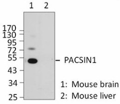 10A6B55_Pacsin1_Antibody_1_WB_060816
