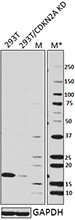 15C10C30_Purified_CDKN2A_Antibody_1_WB_040115_updated