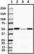 8D4-D6-D11_HRP_ALDH2_Antibody_1_100219