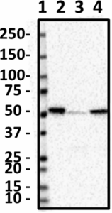 8D4-D6-D11_PURE_ALDH2_Antibody_1_062419