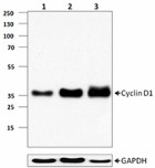 DCS-6_PURE_Cyclin_D1_antibody_WB_102615