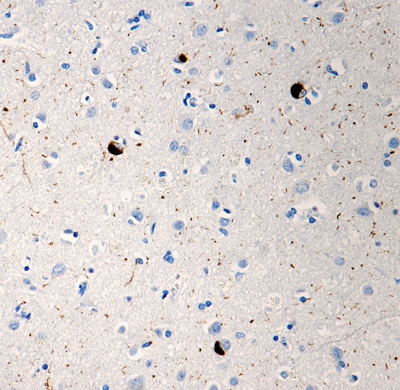 /Files/Images/media_assets/products/product_images/P-syn81A_PURE_a-Syunclein_phospho_Antibody_042518.png