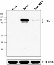 PKC103_PURE_PKC_Antibody_1_WB_083016
