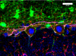F_SMI-31_PURE_NF-H_Antibody_IHCP_Mouse2_011718