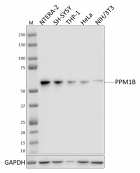 W19264A_PURE_PPM1B_Antibody_1_081921.png