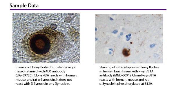 Sample Data: Staining of Lewy Body of substantia nigra neuron stained with 4D6 antibody (SIG-39720). Clone 4D6 reacts with human, mouse, and rat a-Synuclein. It does not react with b-Synuclein or y-Synuclein. Staining of intracytoplasmic Lewy Bodies in human brain tissue with P-syn/81A antibody (MMS-5091). Clone P-syn/81A reacts with human, mouse and rat a-Synuclein phosphorylated at S129.